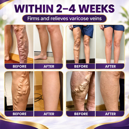 LUHAKA™ VeinRelief Cooling Herbal Leg Gel